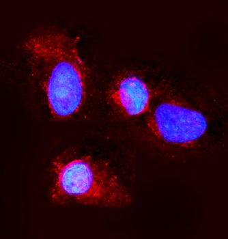 Claudin 3/CLDN3 Rabbit Polyclonal Antibody