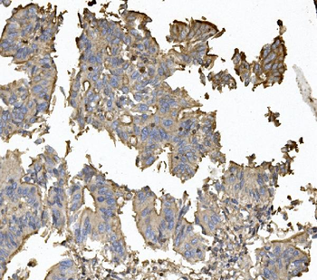 Anti-Claudin 5/CLDN5 Antibody