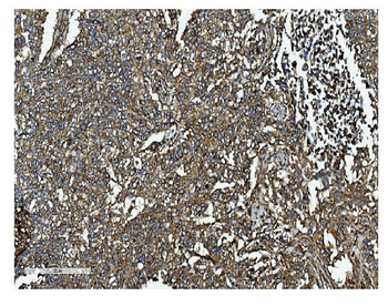 Anti-Clathrin heavy chain/CLTC Antibody
