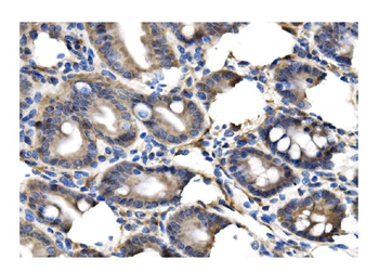 Anti-Clathrin heavy chain/CLTC Antibody