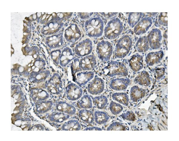 Anti-Clathrin heavy chain/CLTC Antibody