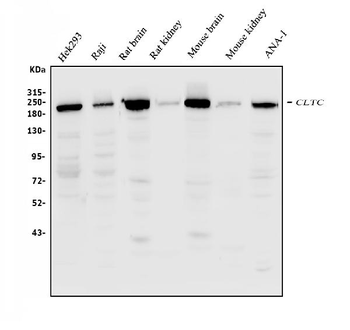 Anti-Clathrin heavy chain/CLTC Antibody