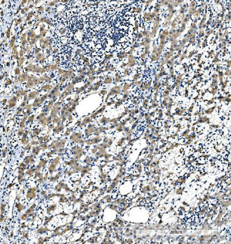 Anti-CYP7A1 Antibody