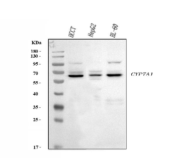 Anti-CYP7A1 Antibody