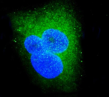 Anti-DDX6 Antibody