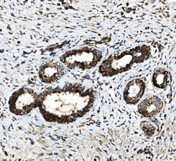 Anti-DDX6 Antibody