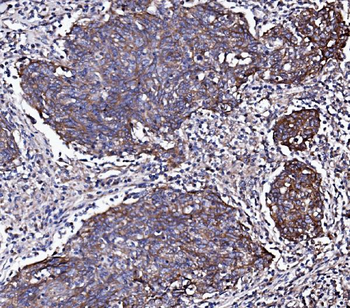 EGFR Antibody
