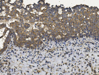 Anti-EIF2AK4 Antibody