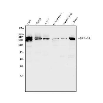 Anti-EIF2AK4 Antibody