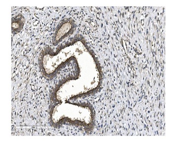 EIF2B1 Antibody