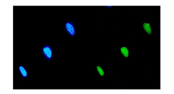 Anti-EIF2B1 Antibody