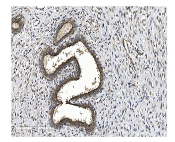Anti-EIF2B1 Antibody