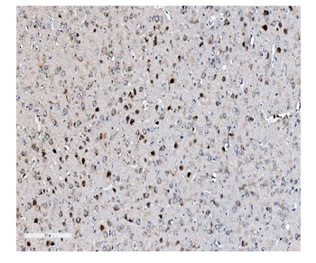 Anti-EIF2B1 Antibody