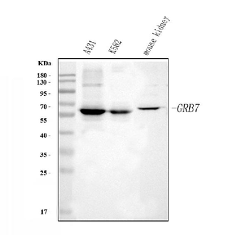 Anti-GRB7 Antibody