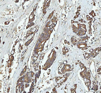 Anti-GRB10 Antibody