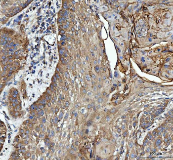 Anti-GRB10 Antibody