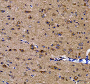 Anti-GRB10 Antibody