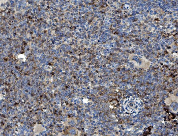 Anti-GRB10 Antibody