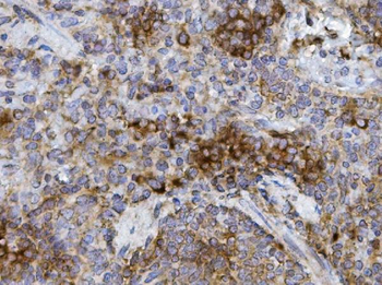 Anti-GRB10 Antibody