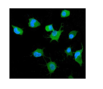 Anti-GRB14 Antibody