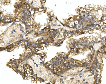 Anti-GRB14 Antibody