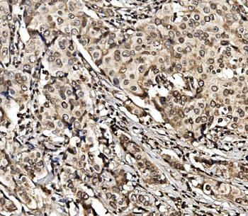 Anti-HIF-1 alpha/HIF1A Antibody