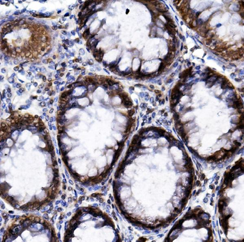 Anti-HIF-1 alpha/HIF1A Antibody