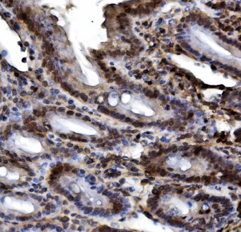 Anti-HIF-1 alpha/HIF1A Antibody