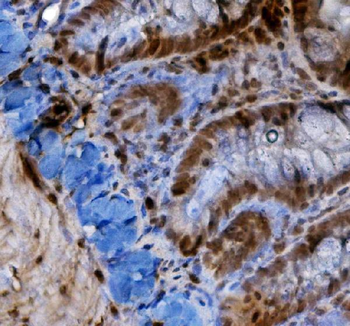 Anti-HIF-1 alpha/HIF1A Antibody
