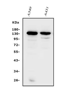Anti-Integrin alpha V/ITGAV Antibody
