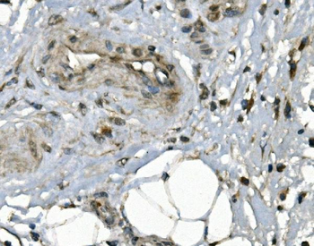 Anti-JUNB Antibody
