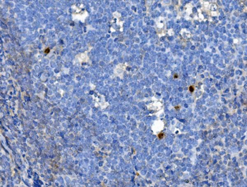 Anti-JUNB Antibody