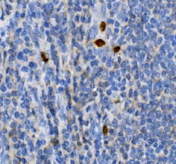 Anti-JUNB Antibody