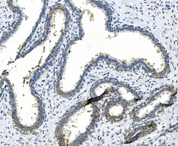 Anti-LPP Antibody