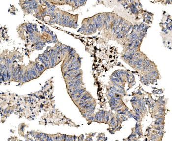 Anti-LPP Antibody