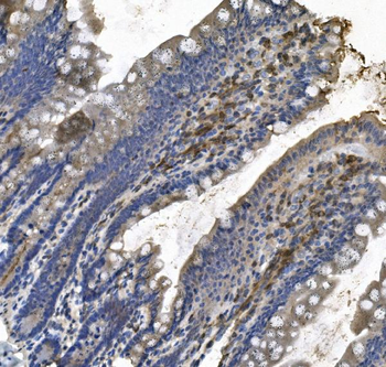 Anti-LPP Antibody