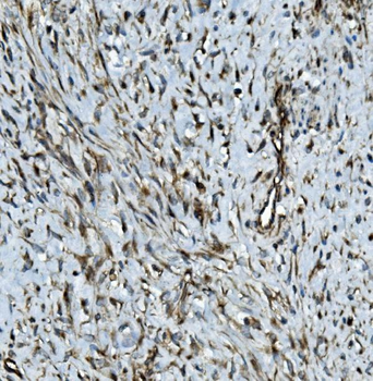 Anti-MMP2 Antibody