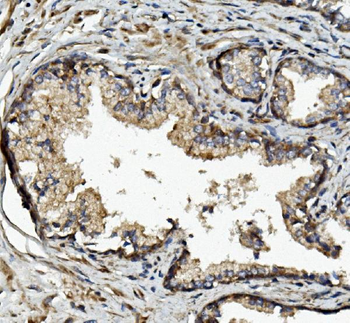 Anti-MMP2 Antibody