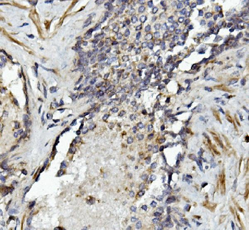 Anti-MMP2 Antibody