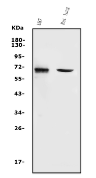 Anti-MMP2 Antibody