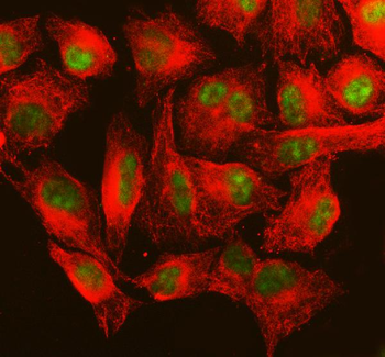 Anti-MSH6 Antibody