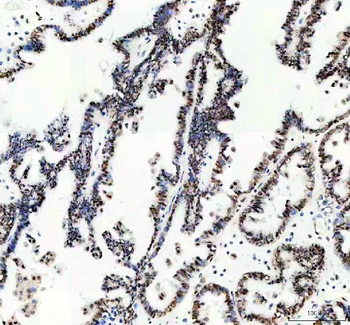 Anti-MSH6 Antibody