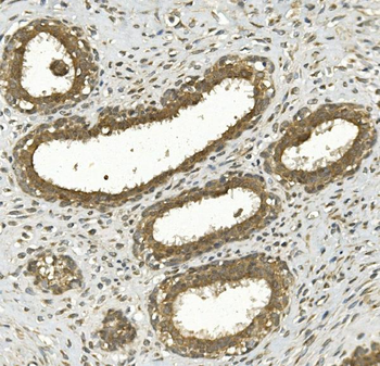 Anti-NFE2L2 Antibody