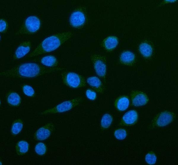 Anti-NOX5 Antibody