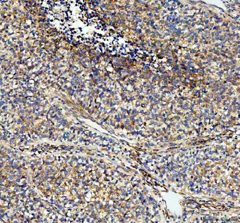 Anti-NOX5 Antibody