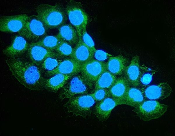 Anti-OXCT1/SCOT Antibody