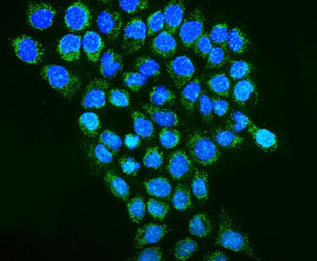Anti-REA/PHB2 Antibody