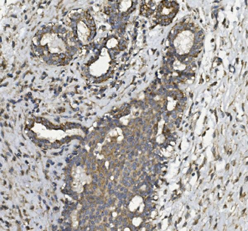 Anti-REA/PHB2 Antibody