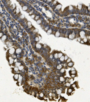 Anti-REA/PHB2 Antibody