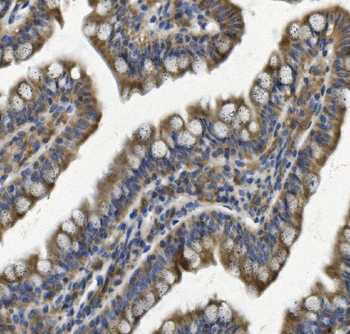 Anti-REA/PHB2 Antibody